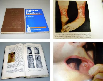 Frakturen und Luxationen 1981 Spezielle Chirurgie 1960